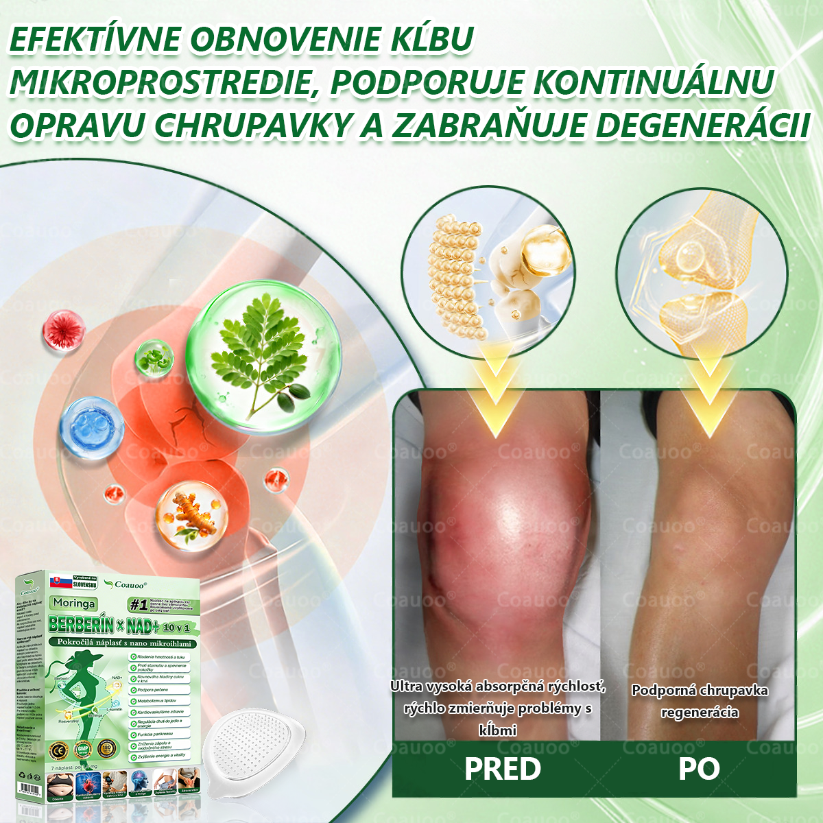 🔥 𝐂𝐨𝐚𝐮𝐨𝐨® Moringa × Berberín × AMPK 10-v-1 Metabolická podpora – nanomikroihlová náplasť (Stačí raz denne, viditeľné výsledky už za 7 dní)  ✅ Na obezitu, ochabnutú pokožku, cukrovku, spánkové apnoe, problémy s kĺbmi a mnohé ďalšie ťažkosti 🔥